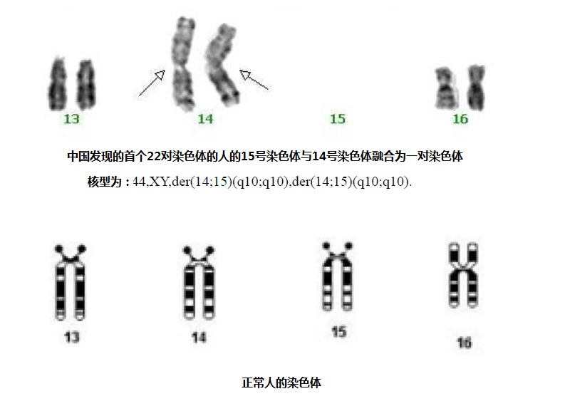 中国22对染色体实例